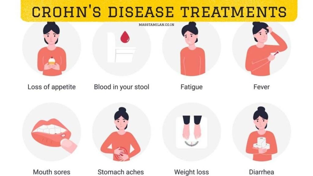 crohn's disease treatments