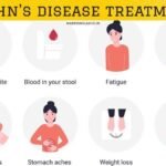crohn's disease treatments